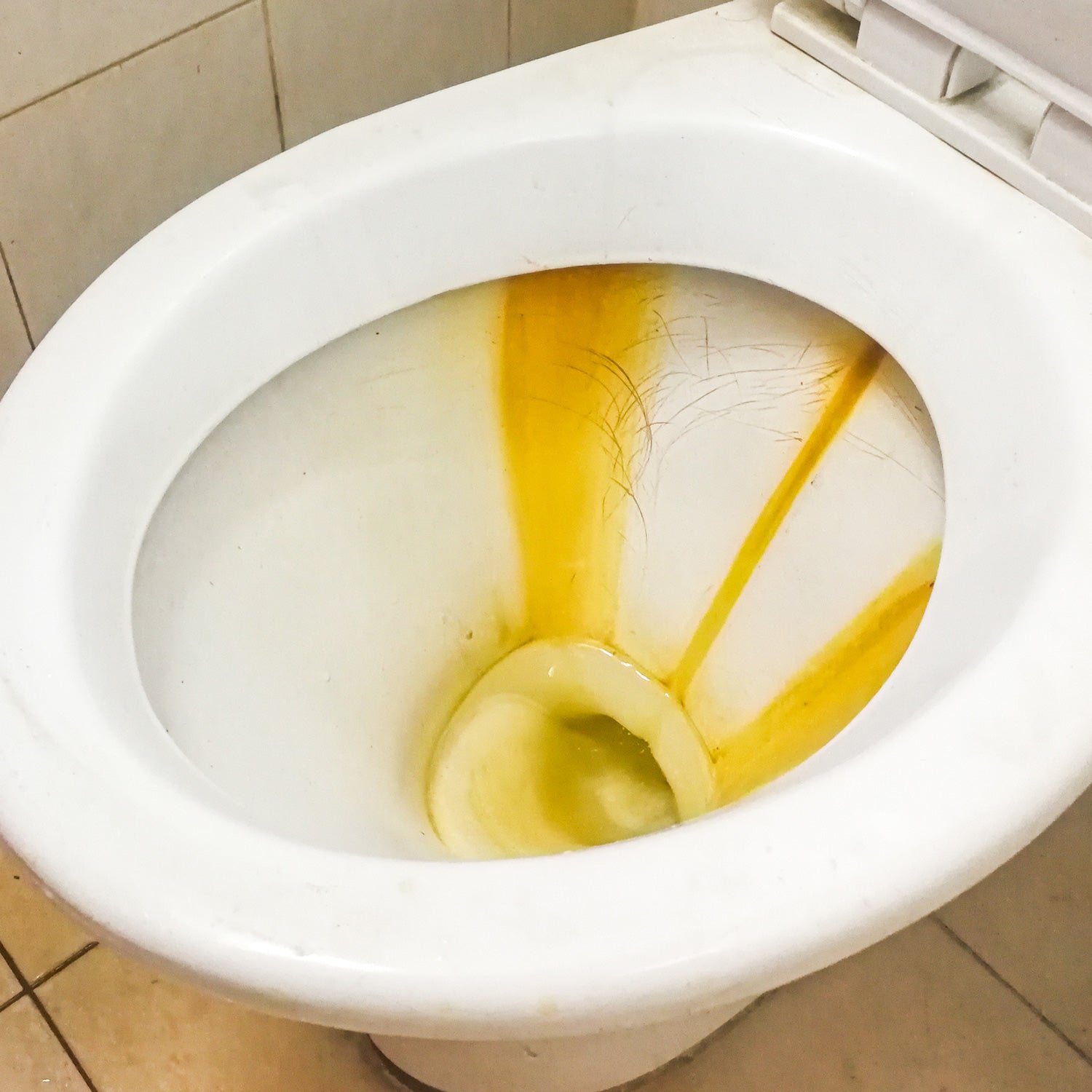 Deka Disincrostante Tartaro Urina e Anticalcare Cassette WC Sanitari –  Resolv