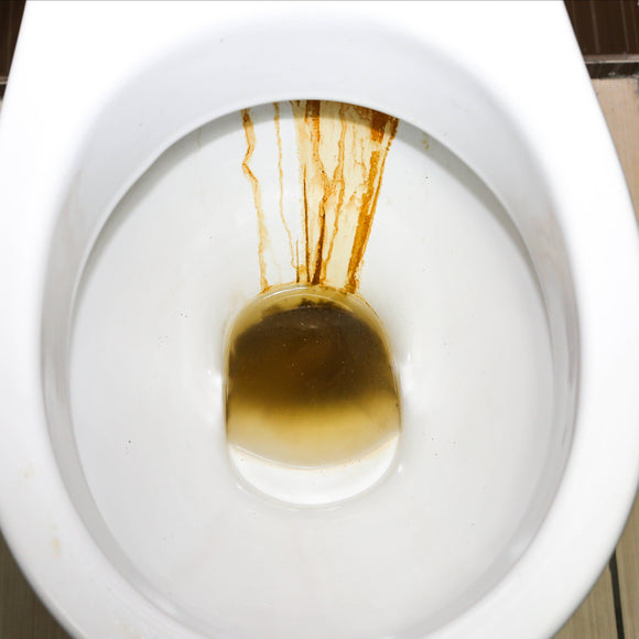 DEKA - Disincrostante Anticalcare WC/Sanitari